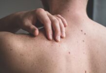 Rural Generalists bringing skin cancer care closer to home